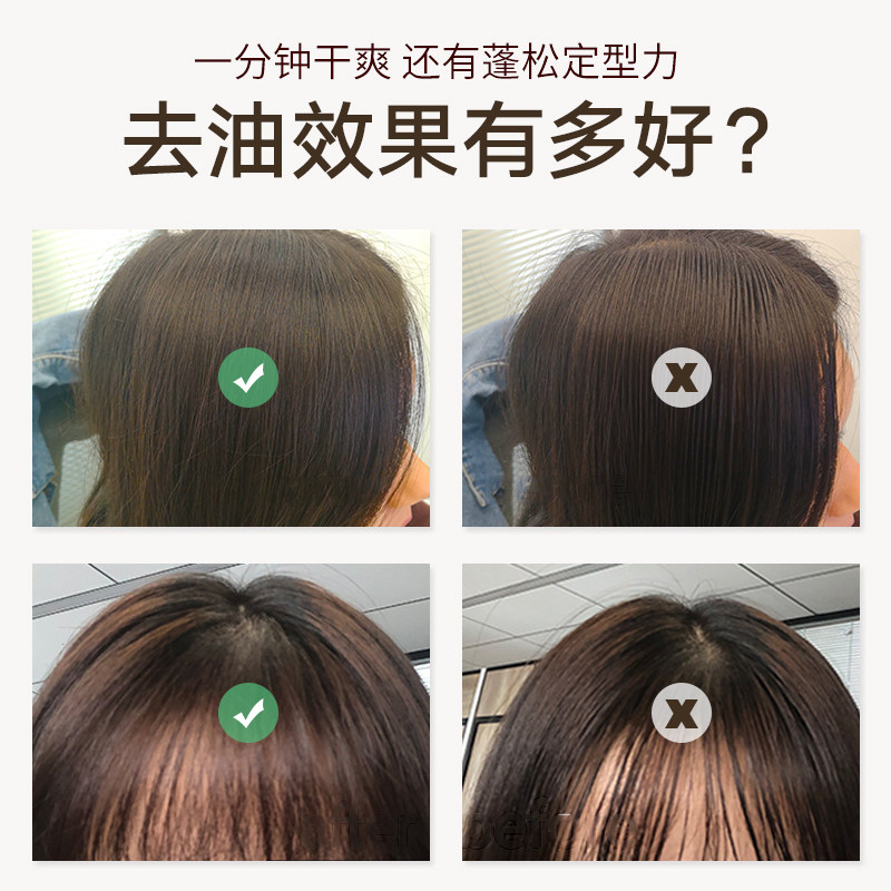 女头发去油腻神器蓬蓬粉油头蓬松粉 维特丝百域头发造型