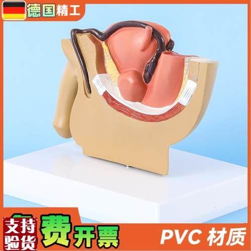 德国】男性盆腔前列腺泌尿生w殖系统睾丸切面解剖模型男科计生展 - 图1