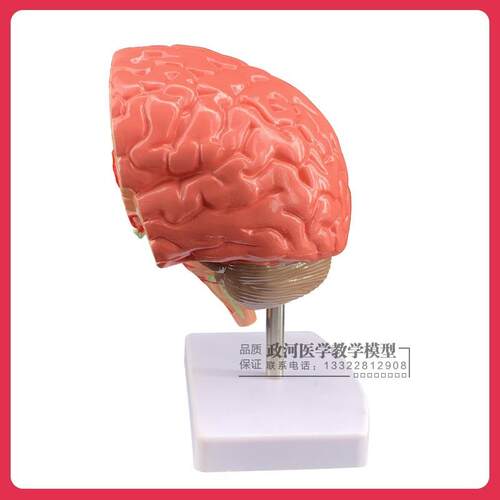 仿真人体脑部疾病模型大脑解剖神经内外科脑病理大Z脑病变模型 - 图1