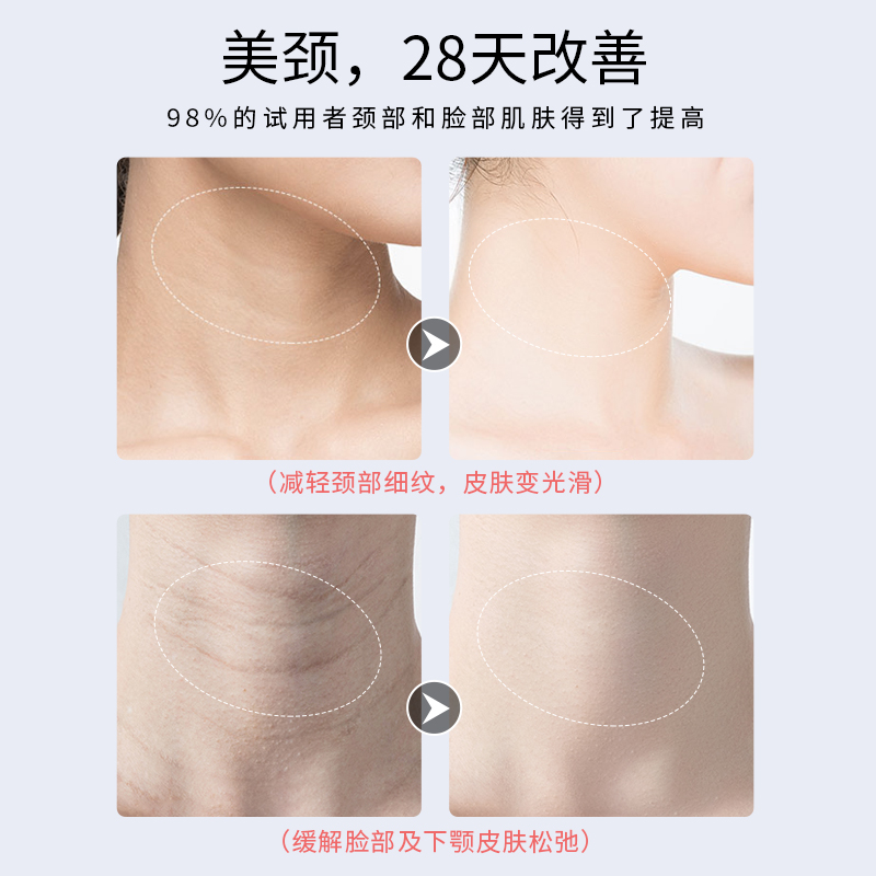 magitech美技旗舰店颈部按摩器去法令纹颈纹神器提拉紧致彩光美颈仪颈部导入按摩仪器2