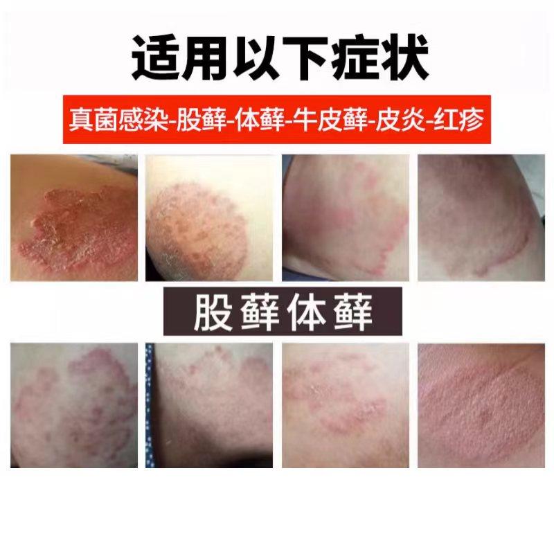  盛和医疗器械专营保健理疗