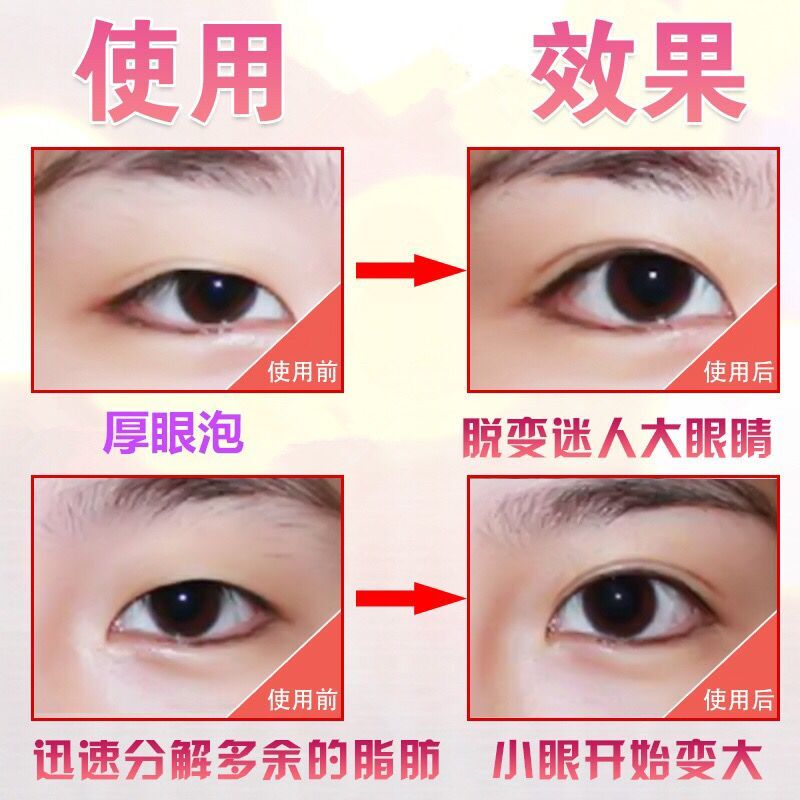 扩眼精油女开眼角精华液单眼皮变双眼皮神器小眼睛变大去肿泡眼男