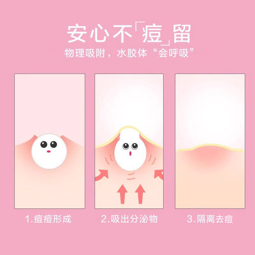 3M人工皮痘痘贴男女生吸痘去痘亲水性水胶体材料隐形贴自由剪裁 - 图3