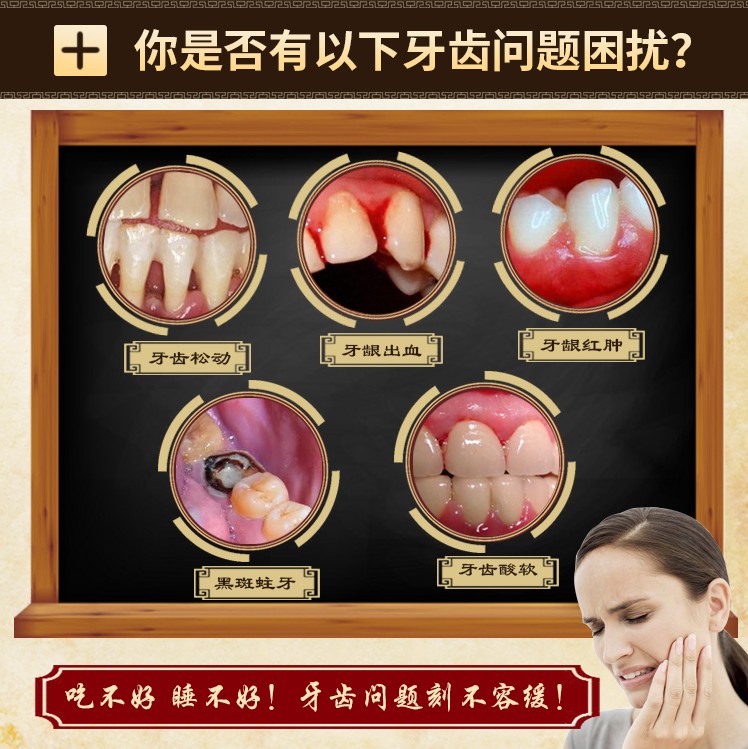 牙龈萎缩修复牙齿松动固齿散牙粉 英族家居牙粉