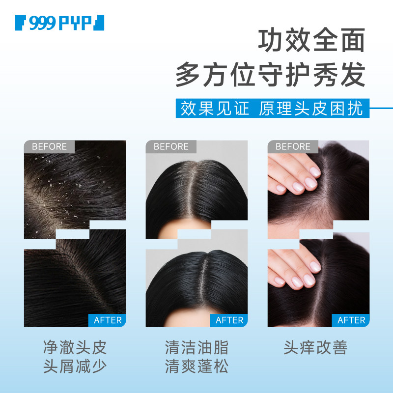999 旭发1%二硫化硒洗发水洗头膏控油止痒洗发液蓬松去头皮屑癣