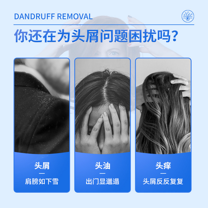 999二硫化硒洗剂去头皮屑非酮康唑 999癣症