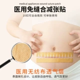 Медицинское натяжение типа