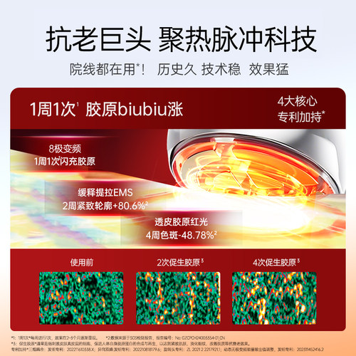 慕苏面部按摩仪器提拉紧致美容导入仪家用全脸淡纹紧轮廓 - 图1