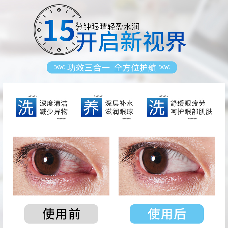 美莉思源旗舰店洗眼液清洁眼部护理液学生清洗眼睛水260ml洗眼睛缓解眼干涩护理0