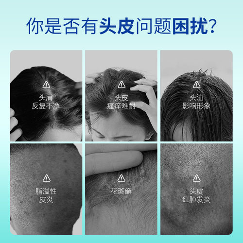 【自营】tedol葡萄牙酮康唑洗剂二硫化硒洗发水脂溢性皮炎去头屑 - 图1