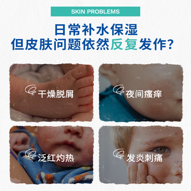 【自营】法国妙思乐思恬雅益佳霜婴幼儿童舒缓干痒红保湿300ml
