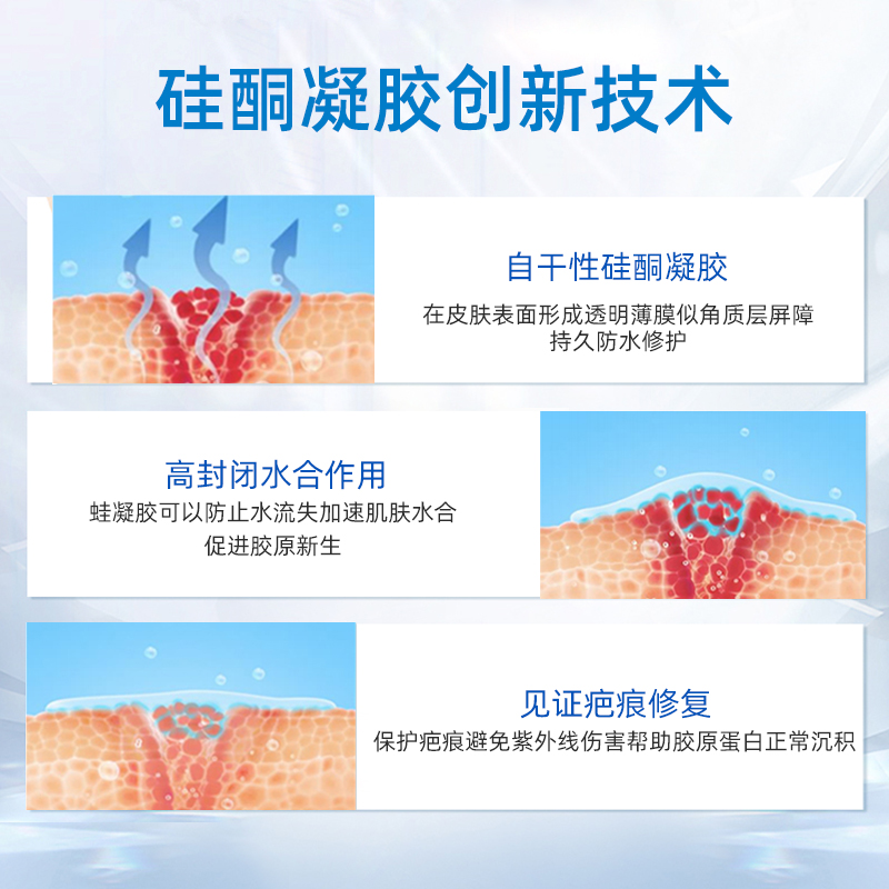 【自营】Dermatix倍舒痕祛疤膏儿童7g宝宝修复凝胶祛疤小恐龙疤痕 - 图2