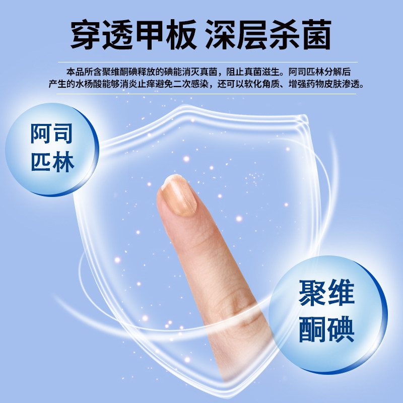 亮甲灰指甲搽剂杀真菌甲癣液灰甲净 亮甲癣症
