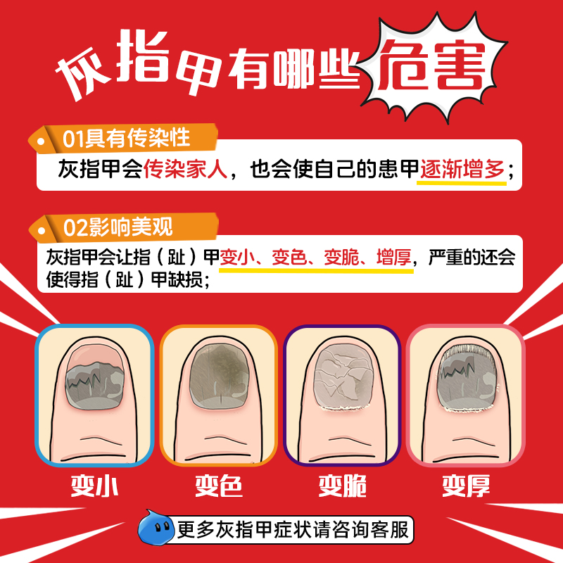 亮甲独特小红标复方聚维酮碘搽剂4ml*4灰指甲专用药效杀真菌正品