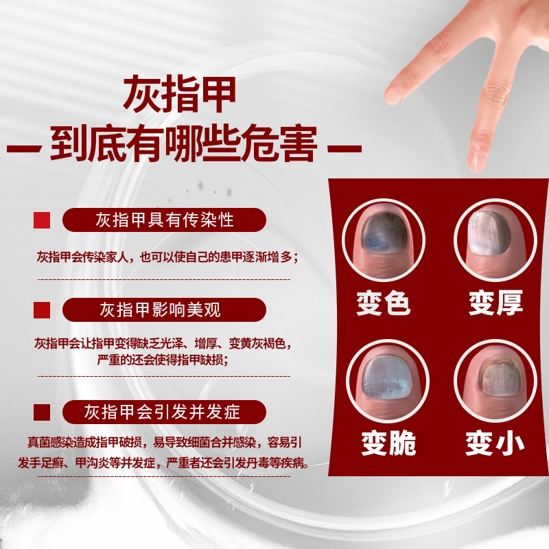 4瓶装亮甲复方聚维酮碘乐泰灰甲净 亮甲癣症