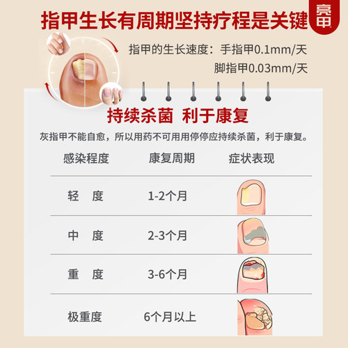 亮甲复方聚维酮碘搽剂4ml*4灰指甲专用药效杀真菌正品 - 图3