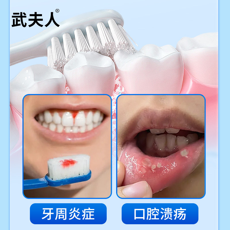 武夫人医用漱口水牙周炎症专用杀菌消炎消肿缓解口腔溃疡红肿疼痛,淘宝优惠券,粉丝福利购,淘宝优惠卷