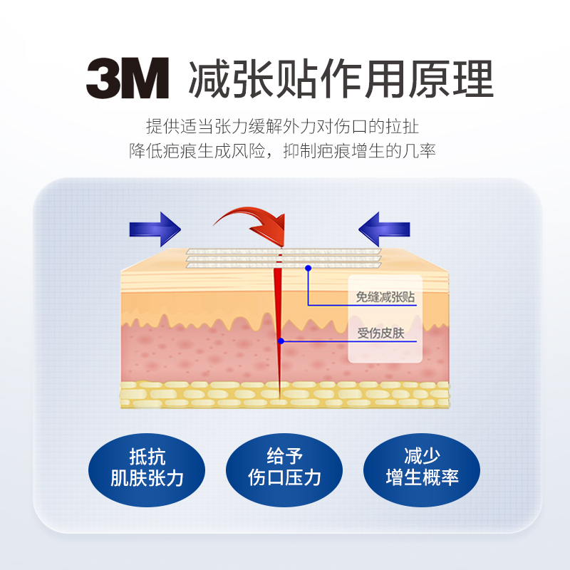 3m减张贴美国免缝合儿童疤痕贴胶带面部伤口胶布剖腹产九院1547-图1