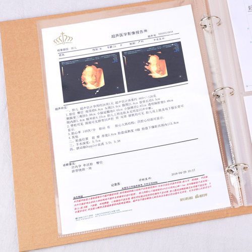 病例 产检资料收纳袋 孕妇手提孕检袋孕期检查报告单子票据孕检单收纳册孕妈多功能a4孕检资料文件夹产检包 - 图1