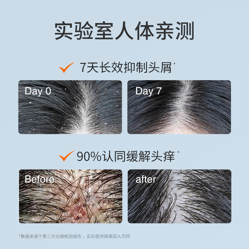 亲初青少年止痒洗发水纯植物去屑止痒洗发中大童男女孩温和无刺激