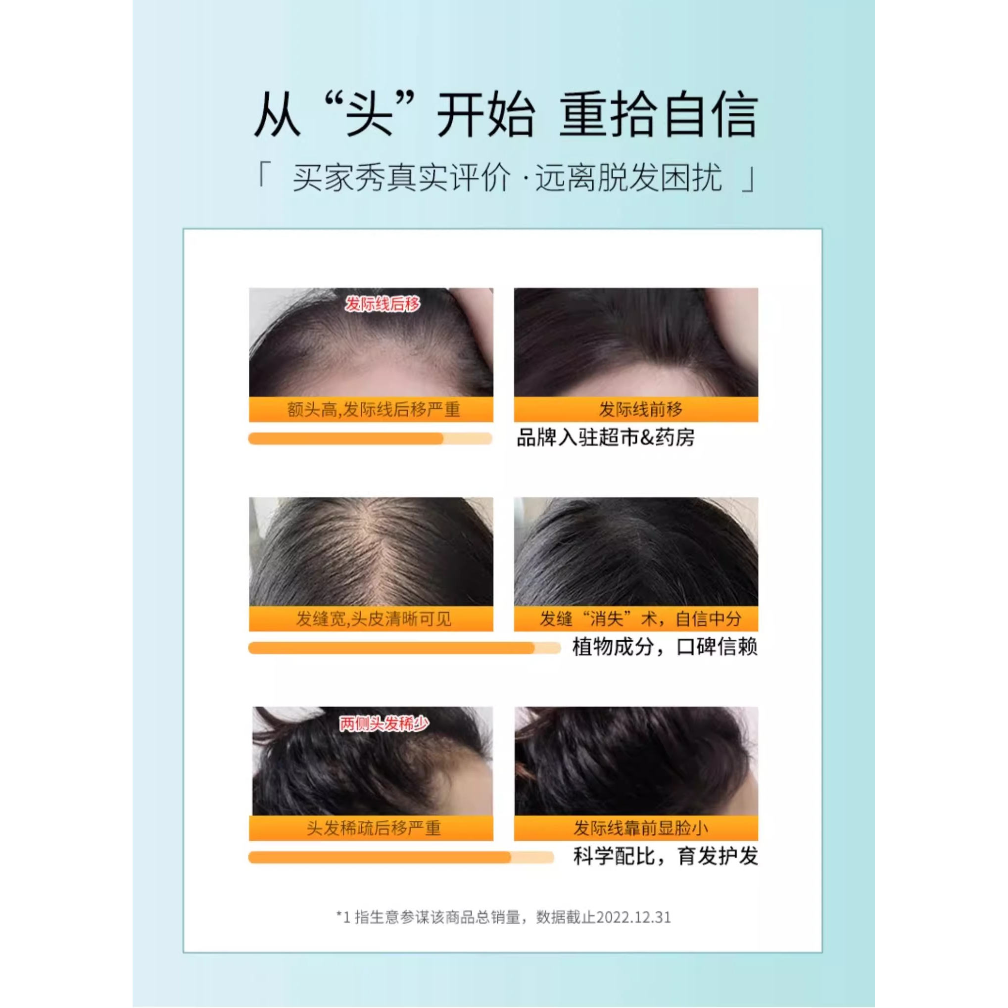 霸王防脱发洗发水控油蓬松洗发露侧柏叶育发洗头膏男女生固发套装 - 图3