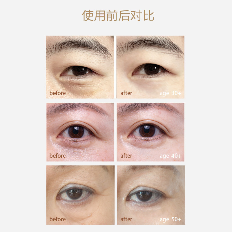  yyooyaill诱颜眼膜