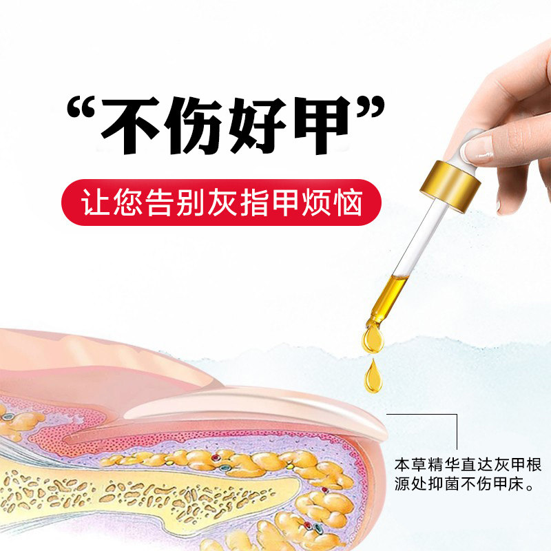 修正灰指甲治疗灰甲正品创口贴 大黄蜂保健品保健理疗