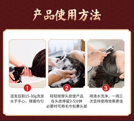 毛炎宁控油头部长痘痘毛囊炎洗发水 御生堂大药房皮肤消毒护理（消）