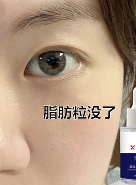 脸部眼睛下面小颗粒油脂粒精华