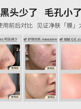 名后玫瑰净肤亮颜泡泡黑炭面膜