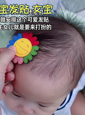 宝宝发贴夹头饰女宝穿搭可爱甜美小碎花刘海贴2026新款少女魔术贴