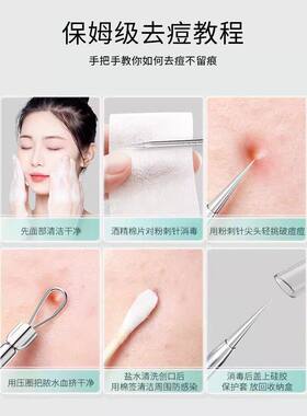 【赠送收纳盒】美容店专用细胞夹美容针粉刺夹粉刺针黑头痘痘针