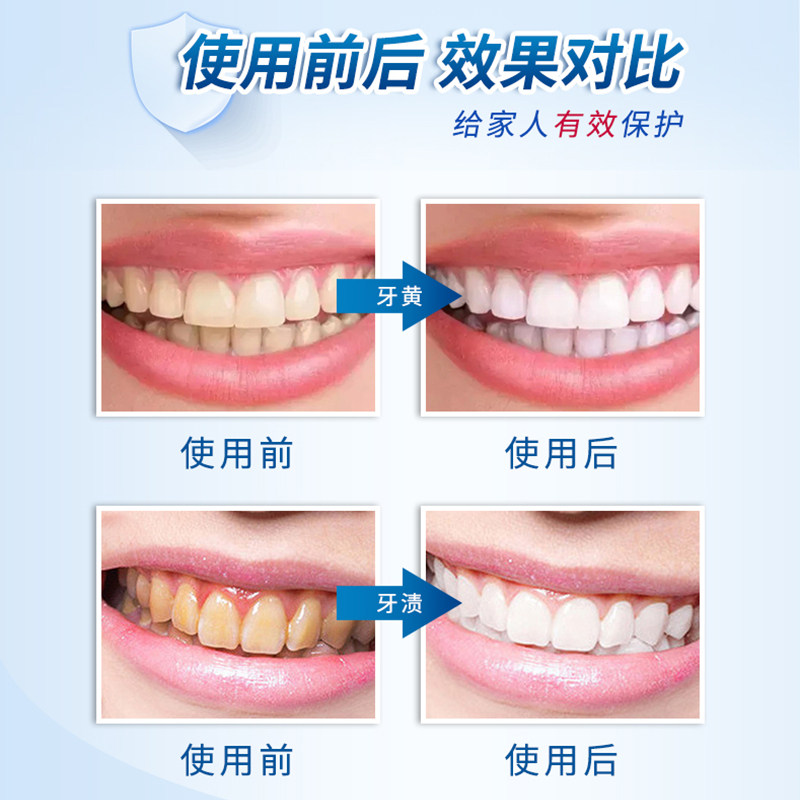日本ourberga亮白洁牙粉牙结石牙石 ourberga牙粉