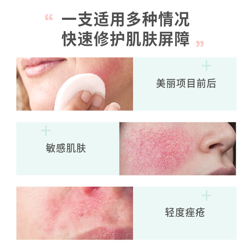  Avene雅漾海外乳液/面霜