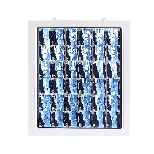 Светодиодные пленки лампы, лампы для чтения, лампы просмотра тройной пленки, двойные ортопедические стоматологические рентгеновские пленки, лампы просмотра медицинских пленок, лампы просмотра пленки