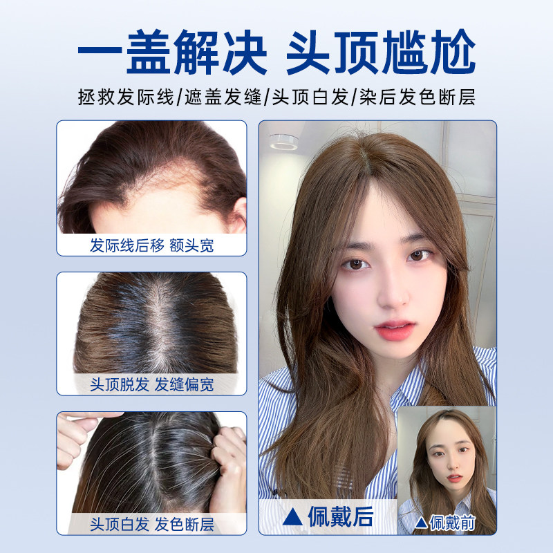 瑞家假发片女头顶蓬松增发量高颅顶假发真发全真人发遮白发补发片,淘宝优惠券,粉丝福利购,淘宝优惠卷