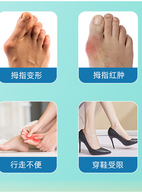 【全网热销10万+】拇向外一次性矫正回正器纠正贴大脚趾走路困难