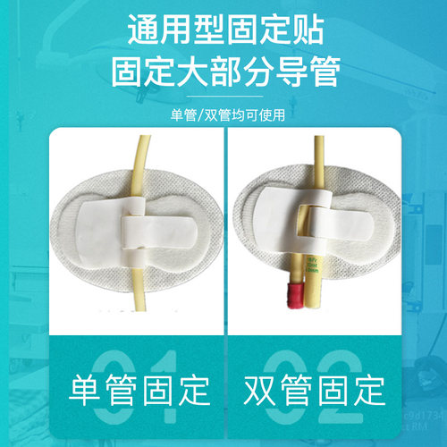 妥能医用体表导管固定贴引流管导尿管装置鼻饲鼻胃管胶布无菌敷料 - 图1