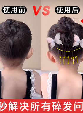 可爱卡通儿童隐形碎发夹后脑勺碎毛发固定整理神器刘海发夹女发卡
