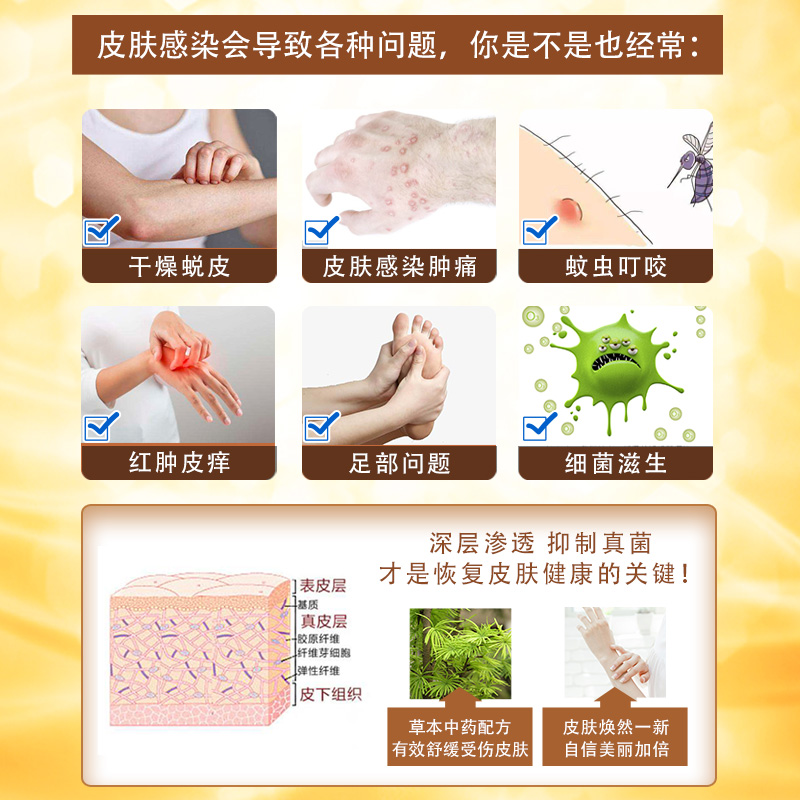 铍养宁舒夫王抑菌乳膏