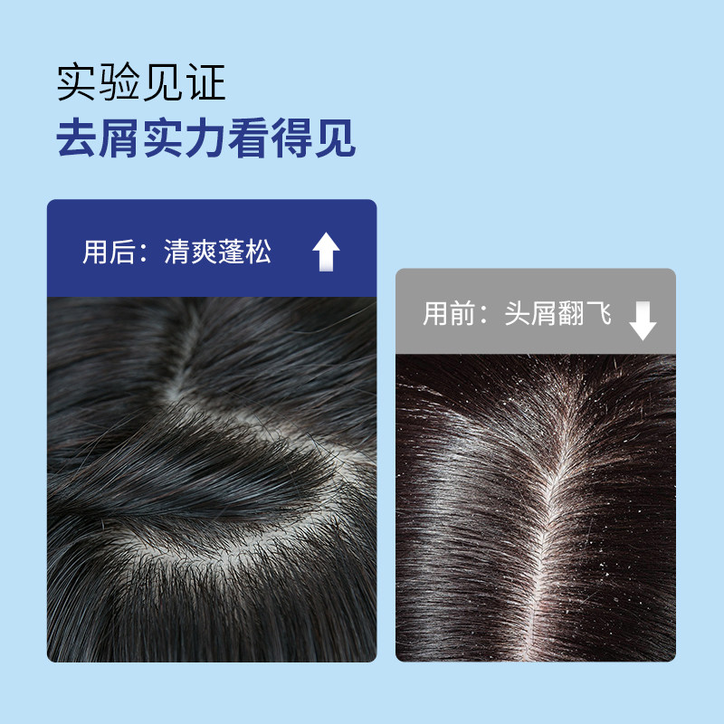  阿里健康大药房洗发水