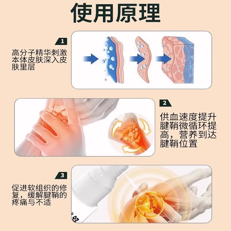 宝元堂腱鞘炎型冷敷凝胶手腕疼痛键健鞘喷雾凝胶官方正品旗舰店JW