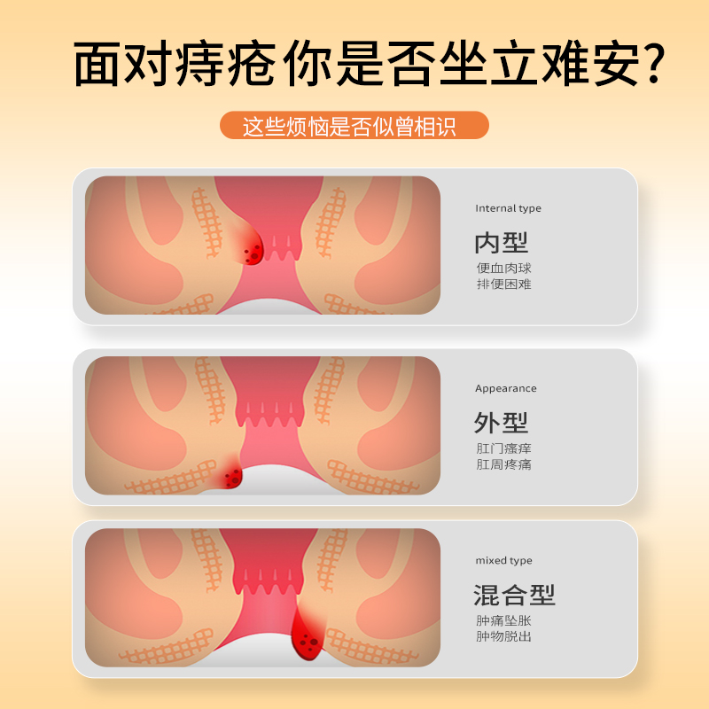 医用卡波姆痔疮膏断痔冷敷凝胶去消肉球男女消痔内外痔疮官方正品