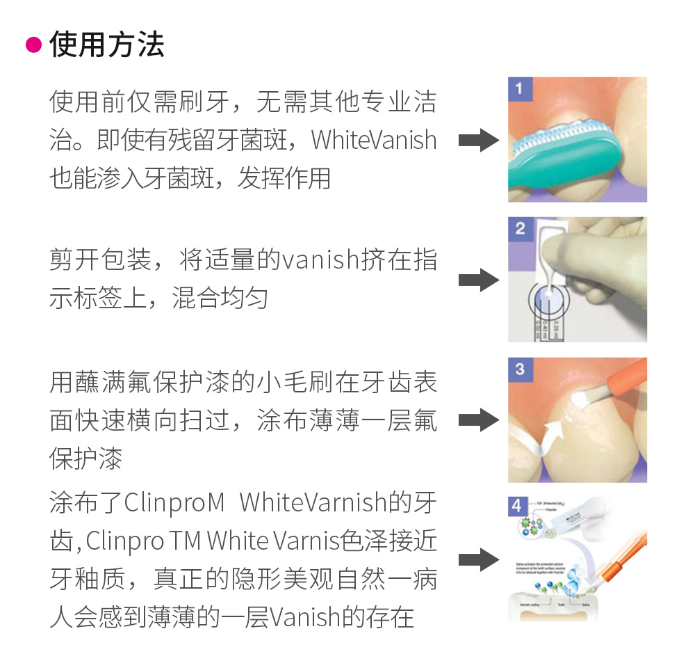 牙科口腔牙科氟保护漆儿童牙齿蛀牙0.5ml保护牙齿成人正品美国3M - 图2