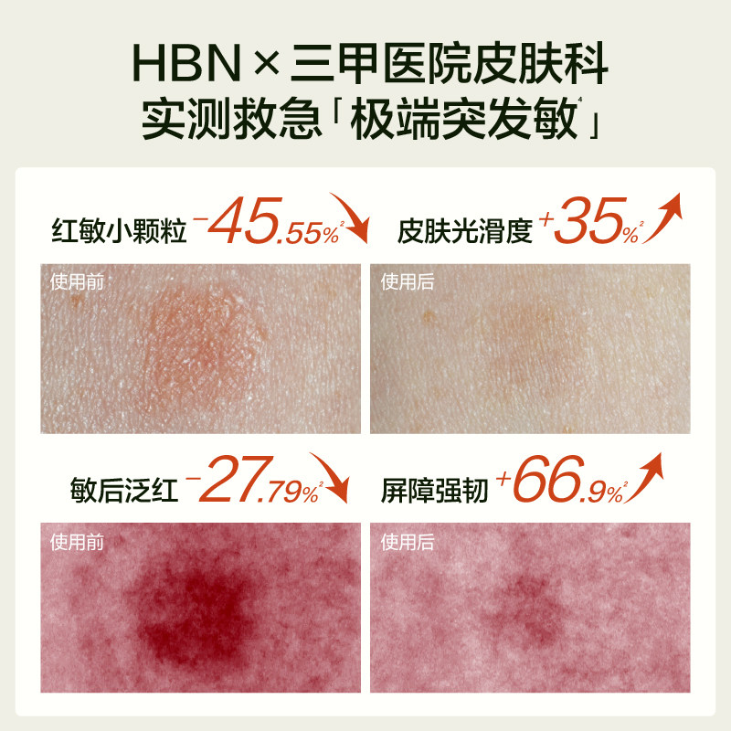【全新升级】HBN B5闪修霜3.0特润霜补水保湿舒缓敏感修护B5面霜