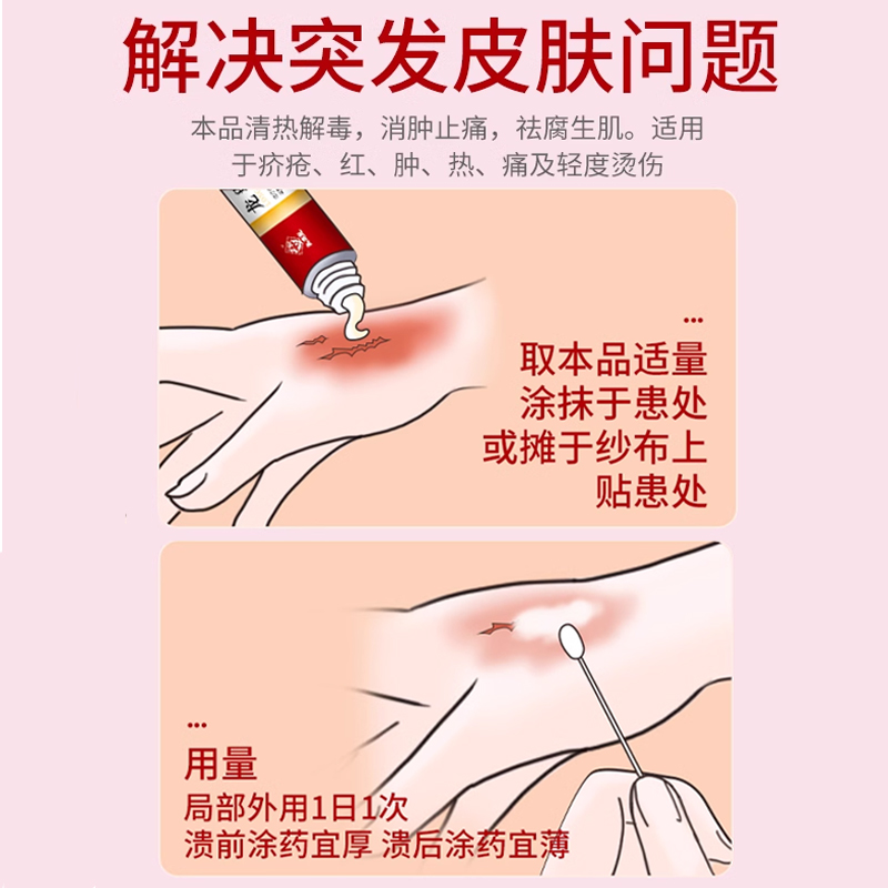 马应龙龙珠软膏15g解毒消肿烫伤药膏褥疮蚊虫叮咬长包皮肤止痒 - 图2