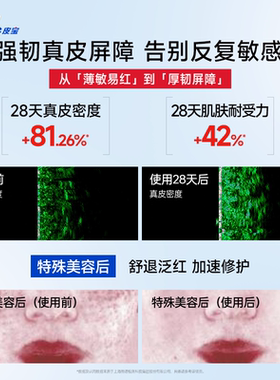 皮宝重磅新品屏障修护霜