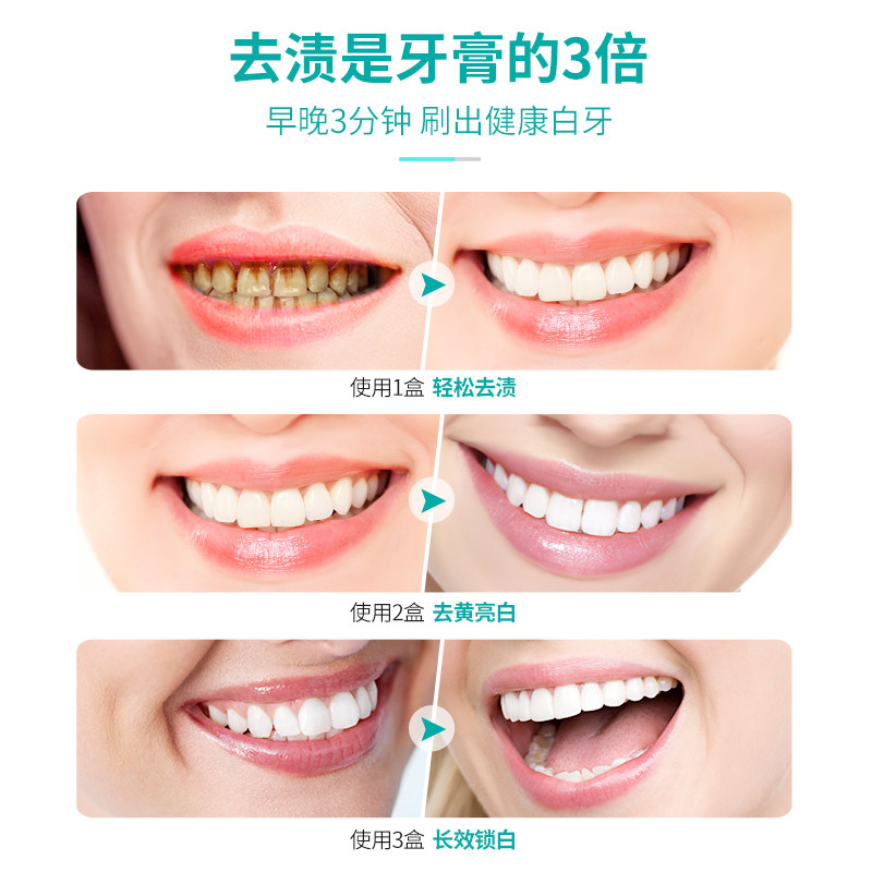 去黄洗白牙齿亮白去除洗牙非变牙粉 modernc牙粉