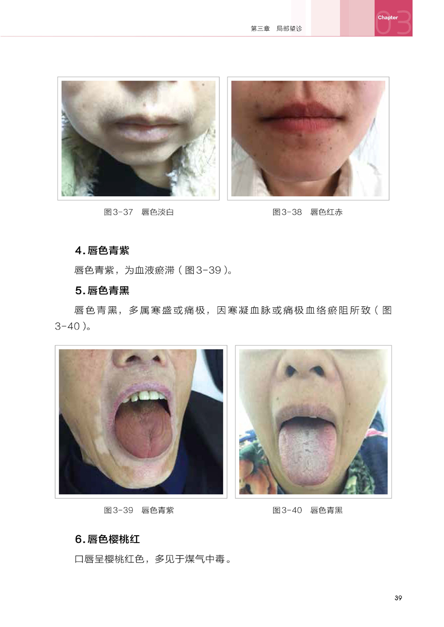 正版中医望诊与舌诊彩色图解望诊舌诊入门提高书望诊舌诊理论临床实践结合望诊舌诊知识参考书临床中医师学习书中医诊断方法书籍_虎窝淘