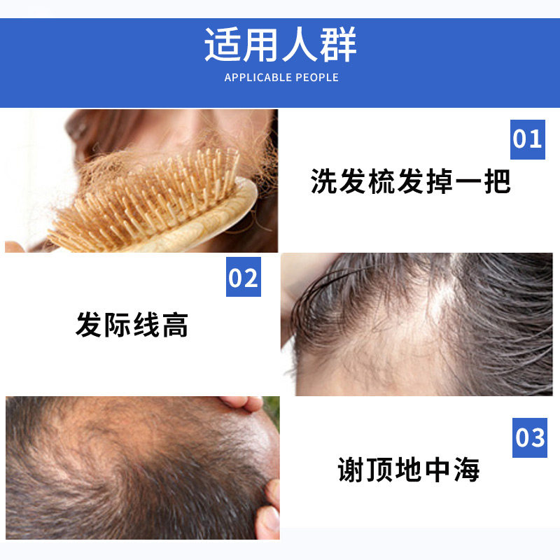 bayer priorin防脱发 3Hapopro海外保健理疗